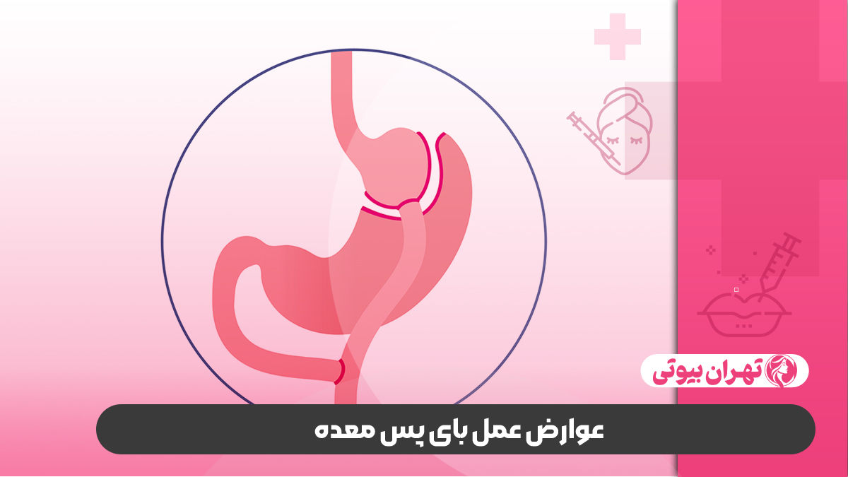 10 بهترین دکتر عمل بای پس معده در کرج