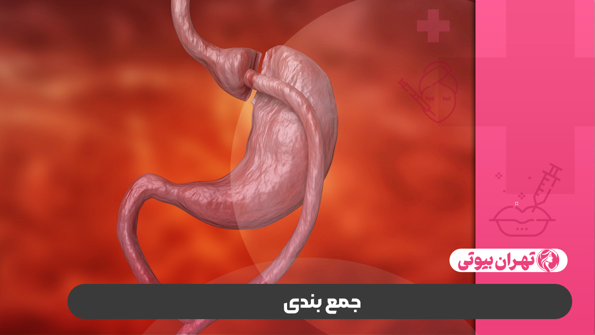 10 بهترین دکتر عمل بای پس معده در کرج