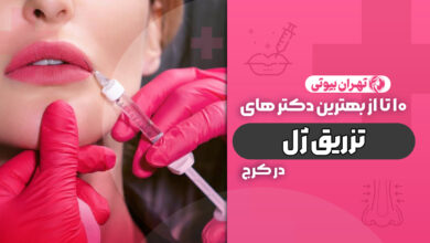 10 بهترین دکتر تزریق ژل در کرج