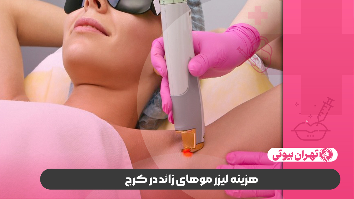 10 بهترین مرکز لیزر موهای زائد در کرج