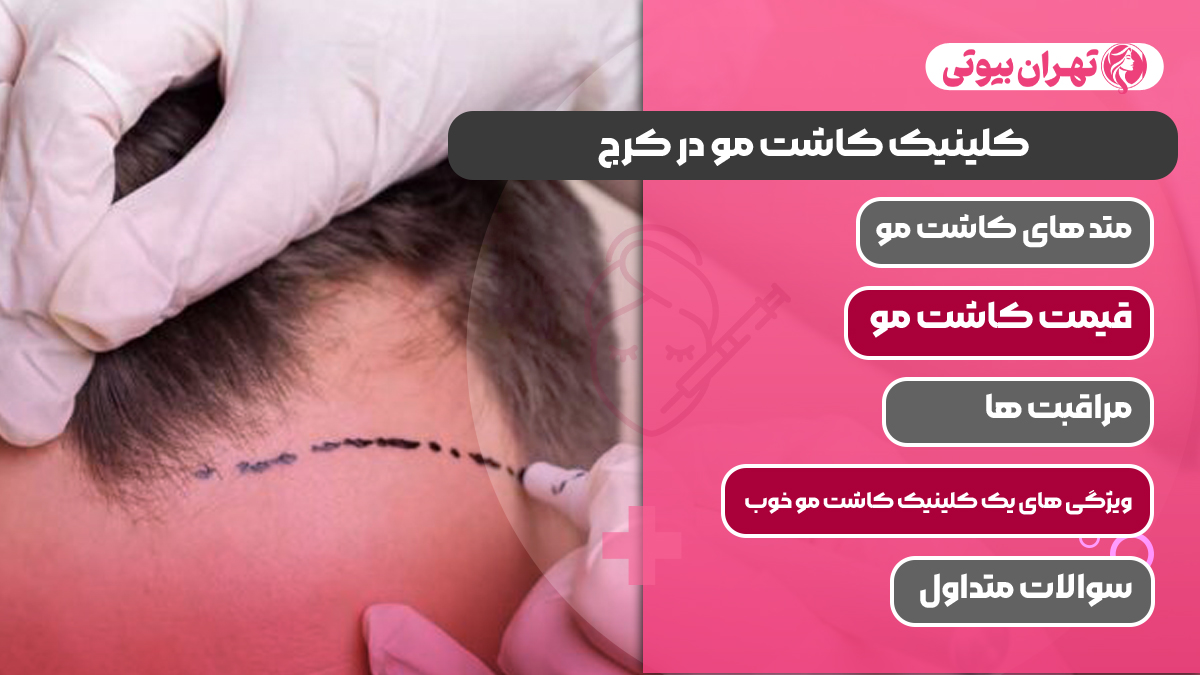 10 بهترین کلینیک کاشت مو در کرج