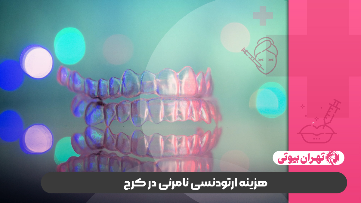 10 بهترین دکتر ارتودنسی نامرئی در کرج