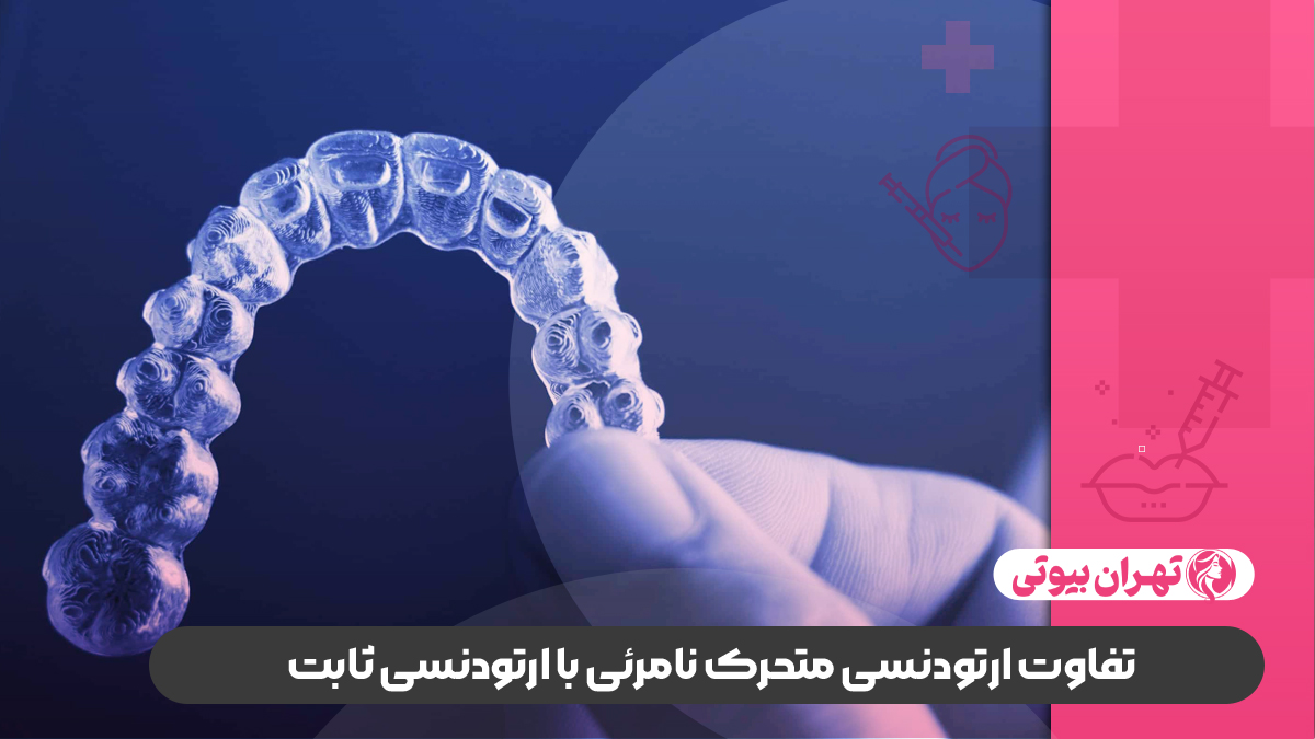 10 بهترین دکتر ارتودنسی نامرئی در کرج