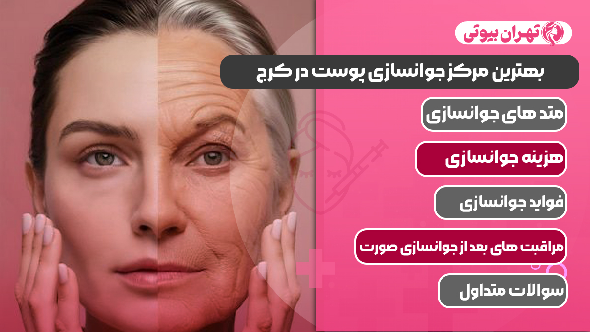10 بهترین مرکز جوانسازی پوست در کرج