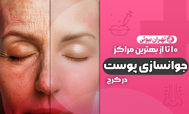 10 بهترین مرکز جوانسازی پوست در کرج