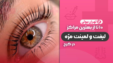 10 بهترین مرکز لیفت و لمینت مژه در کرج