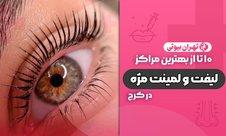 10 بهترین مرکز لیفت و لمینت مژه در کرج