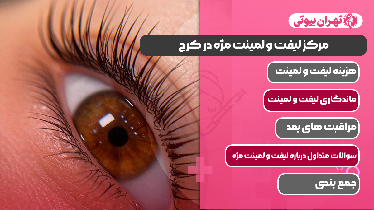 10 بهترین مرکز لیفت و لمینت مژه در کرج