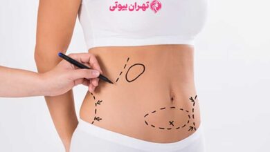 10 بهترین جراح لیپوماتیک در کرج