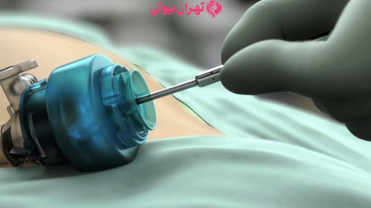 10 بهترین جراح لیپوماتیک در کرج