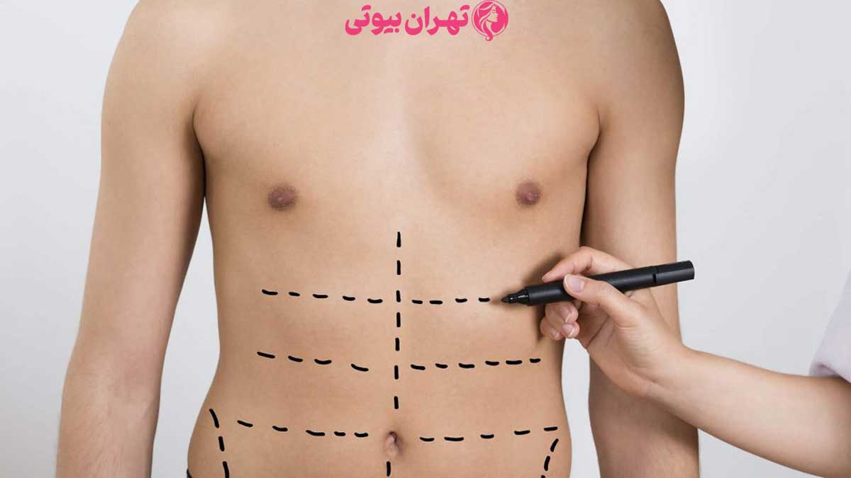 10 بهترین جراح لیپوماتیک در کرج