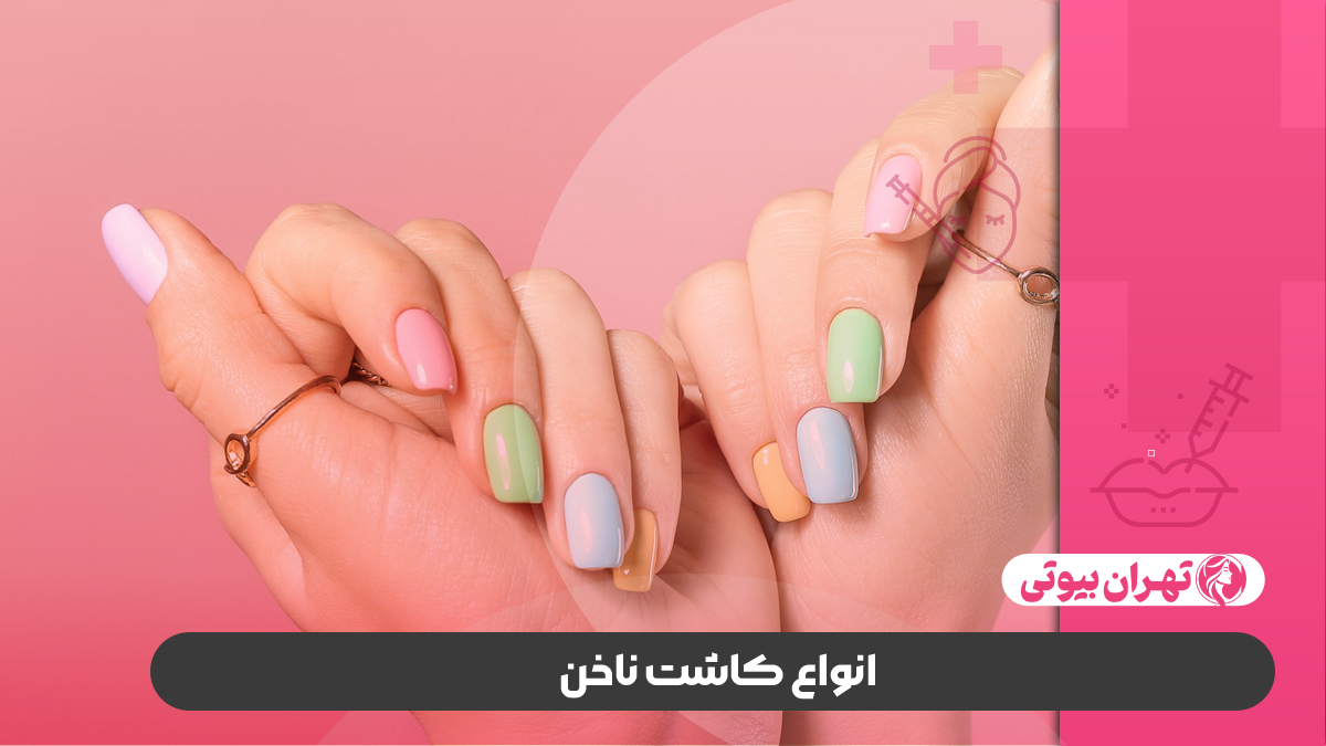 10 بهترین سالن کاشت ناخن در کرج