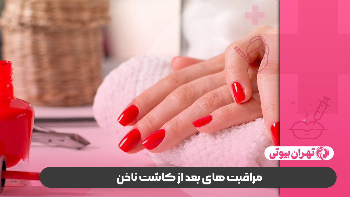 10 بهترین سالن کاشت ناخن در کرج