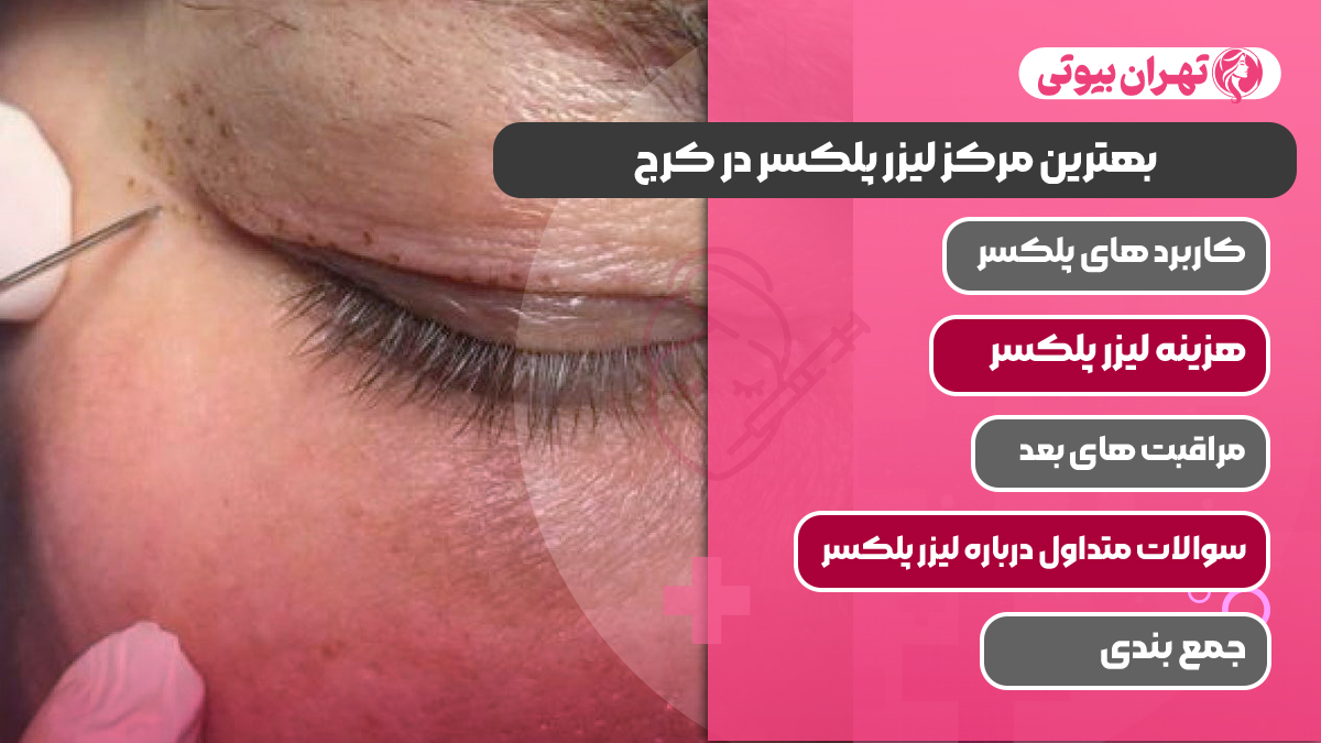 10 بهترین مرکز لیزر پلکسر در کرج