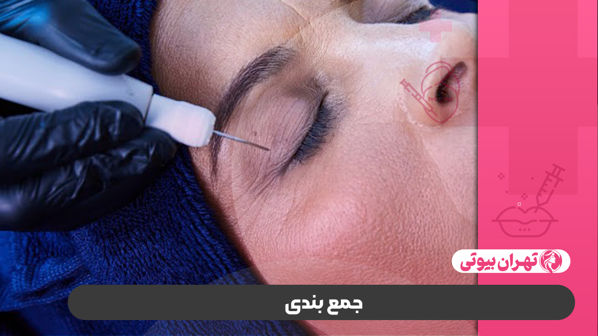 10 بهترین مرکز لیزر پلکسر در کرج