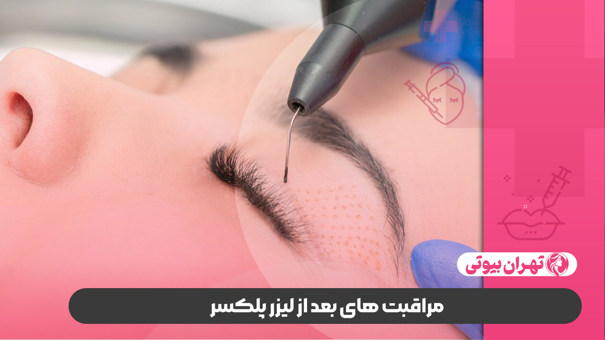 10 بهترین مرکز لیزر پلکسر در کرج