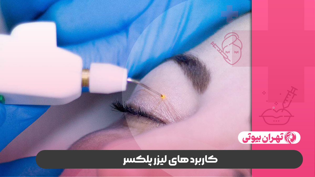 10 بهترین مرکز لیزر پلکسر در کرج