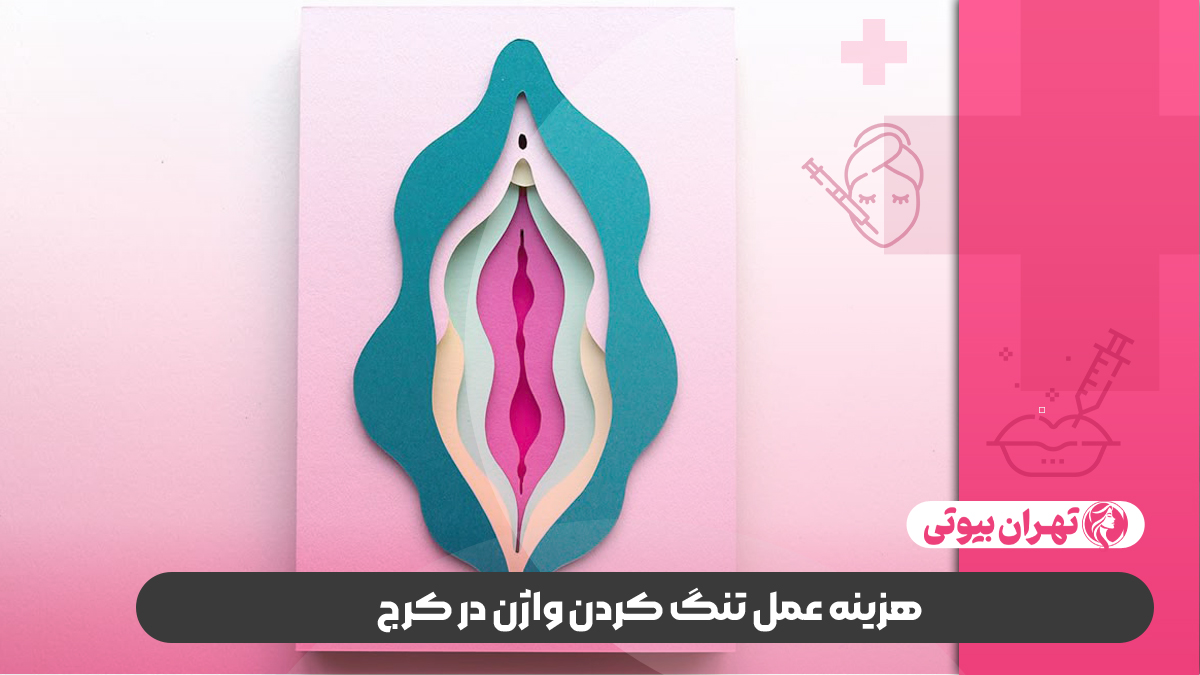 10 بهترین دکتر تنگ کردن واژن ( واژینوپلاستی) در کرج