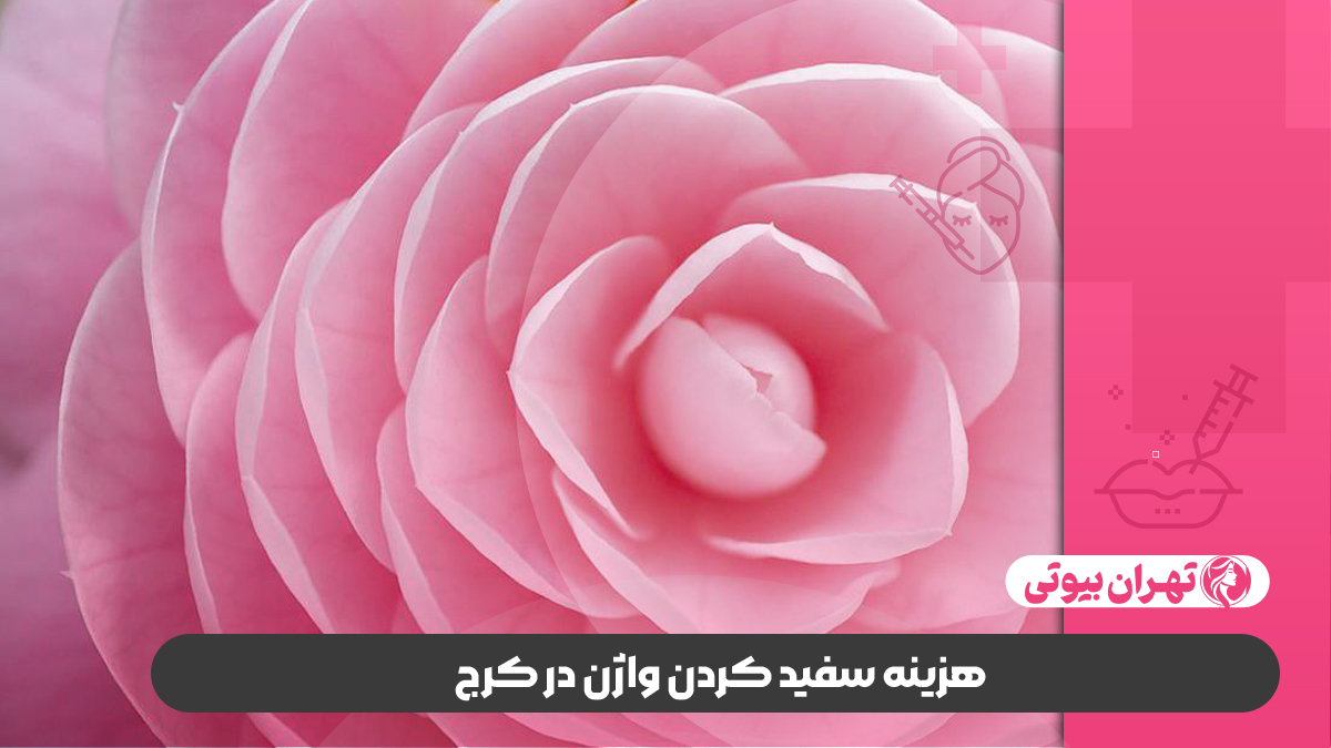 10 بهترین دکتر سفید کردن واژن در کرج