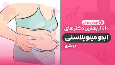 10 بهترین دکتر ابدومینوپلاستی در کرج