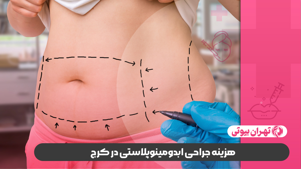 10 بهترین دکتر ابدومینوپلاستی در کرج
