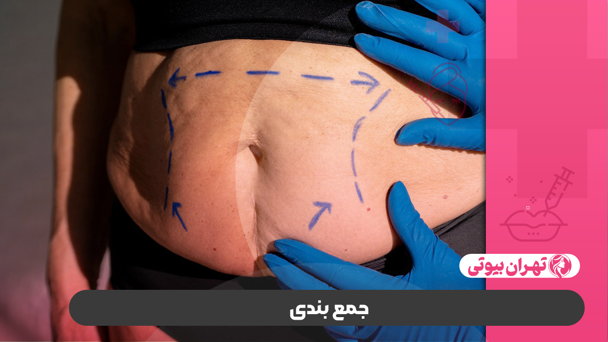 10 بهترین دکتر ابدومینوپلاستی در کرج