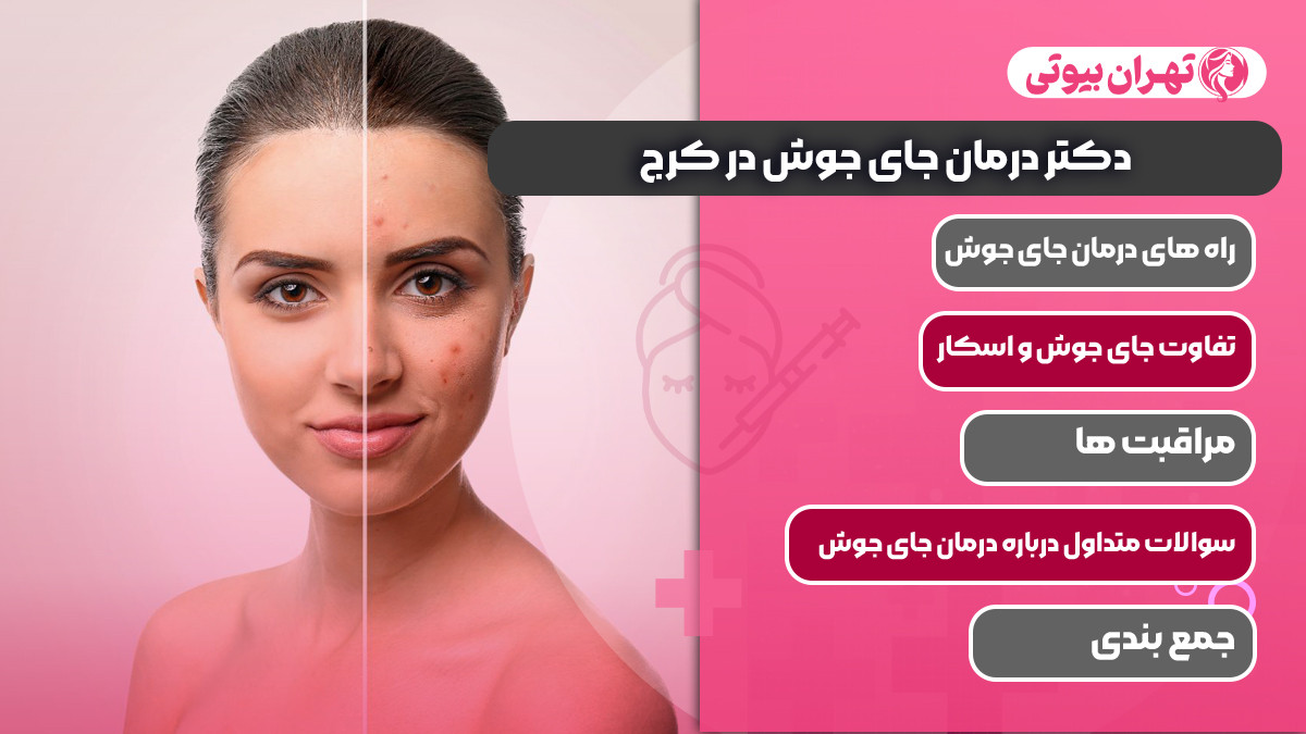 10 بهترین دکتر درمان جای جوش در کرج