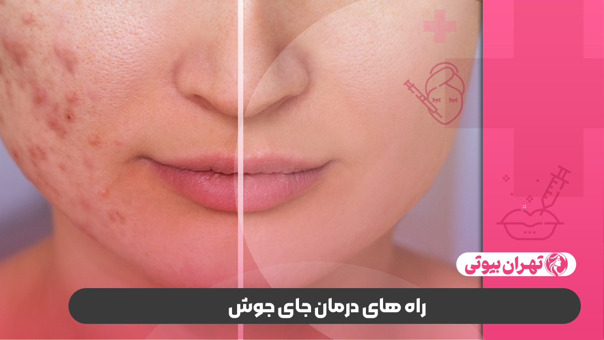 10 بهترین دکتر درمان جای جوش در کرج