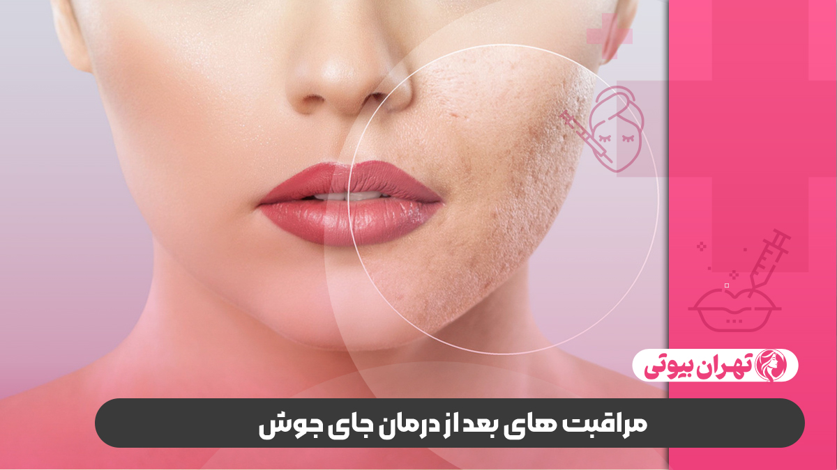 10 بهترین دکتر درمان جای جوش در کرج
