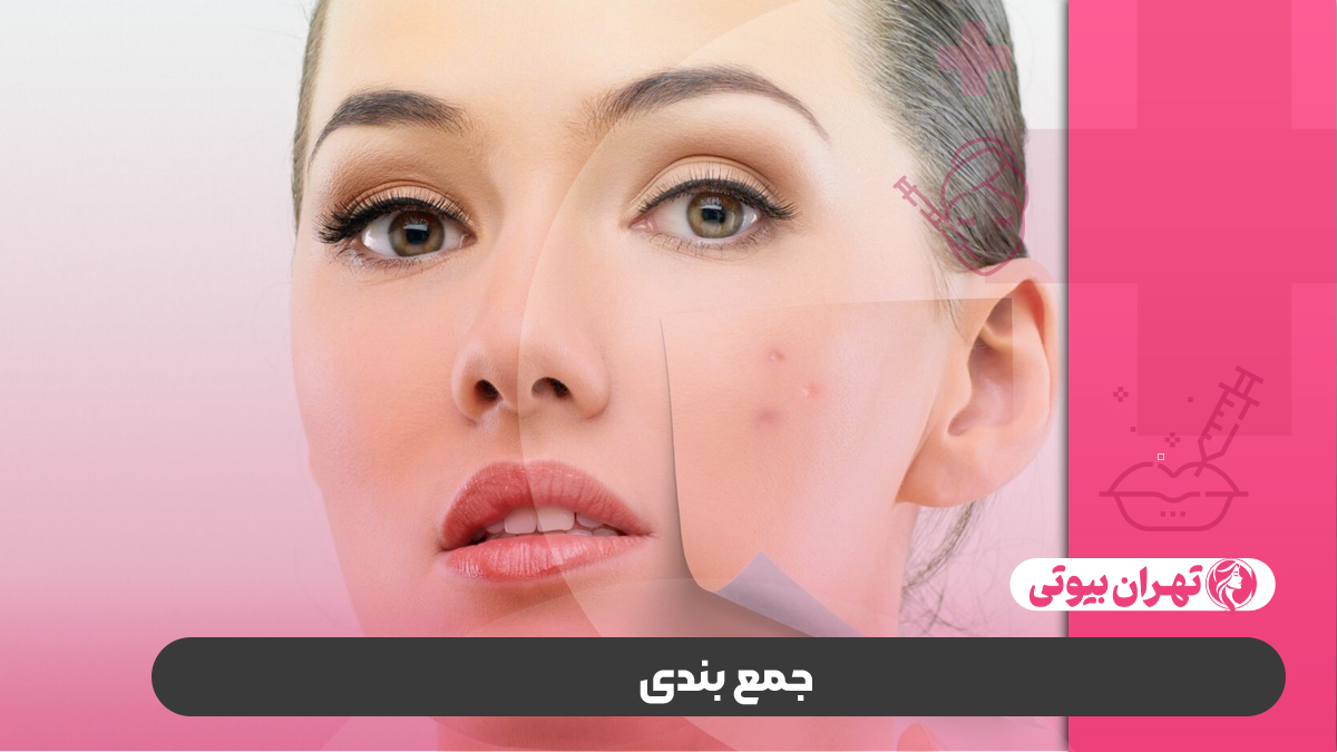 10 بهترین دکتر درمان جای جوش در کرج