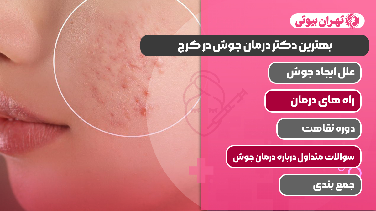 10 بهترین دکتر درمان جوش در کرج