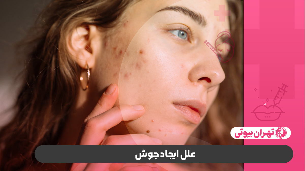 10 بهترین دکتر درمان جوش در کرج