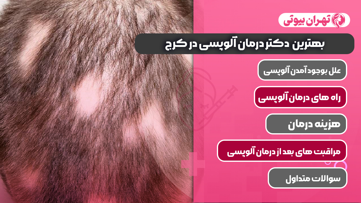 10 بهترین دکتر درمان آلوپسی در کرج