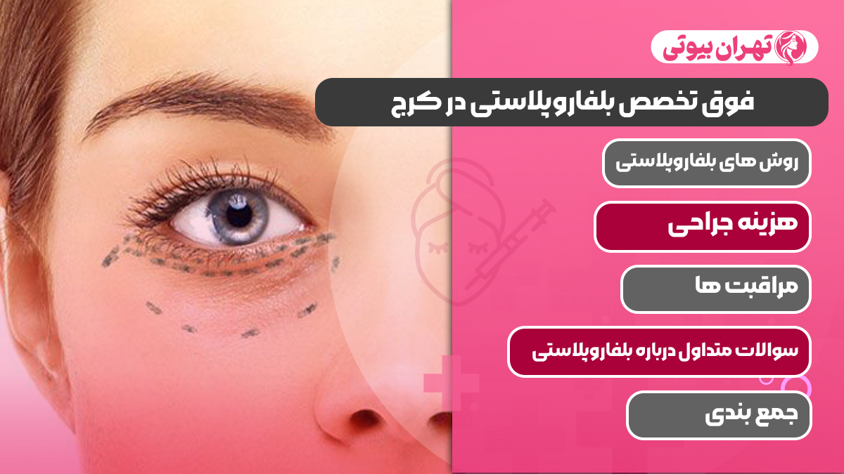 10 بهترین دکتر فوق تخصص بلفاروپلاستی در کرج