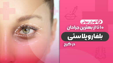 10 بهترین دکتر فوق تخصص بلفاروپلاستی در کرج