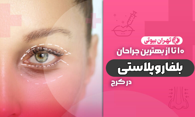 10 بهترین دکتر فوق تخصص بلفاروپلاستی در کرج