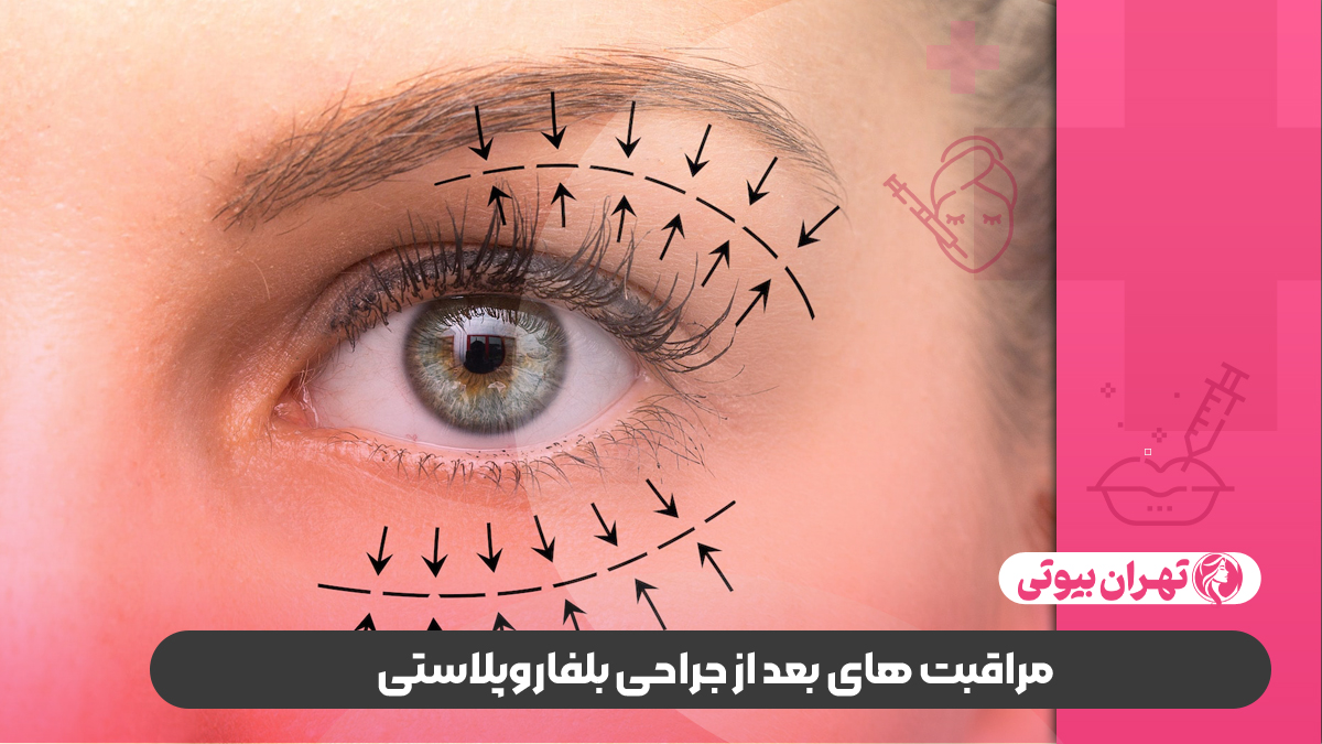 10 بهترین دکتر فوق تخصص بلفاروپلاستی در کرج