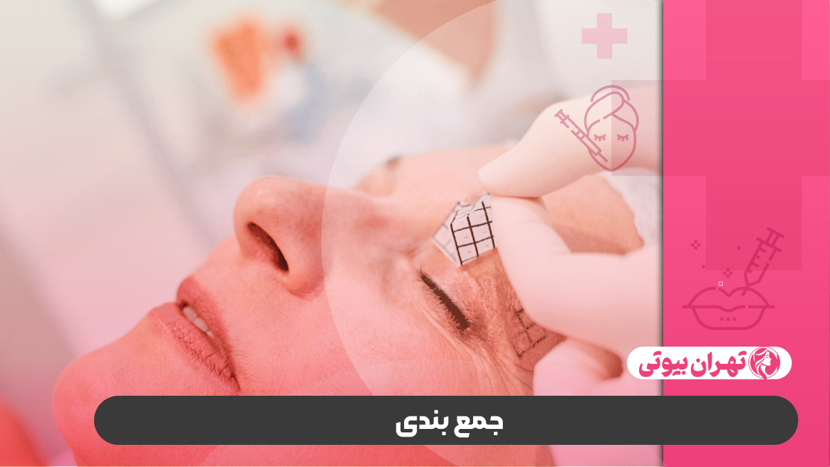 10 بهترین دکتر فوق تخصص بلفاروپلاستی در کرج