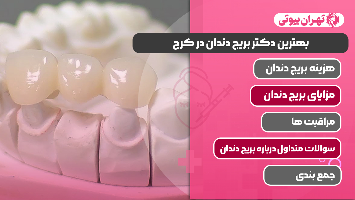 10 بهترین دکتر بریج دندان در کرج