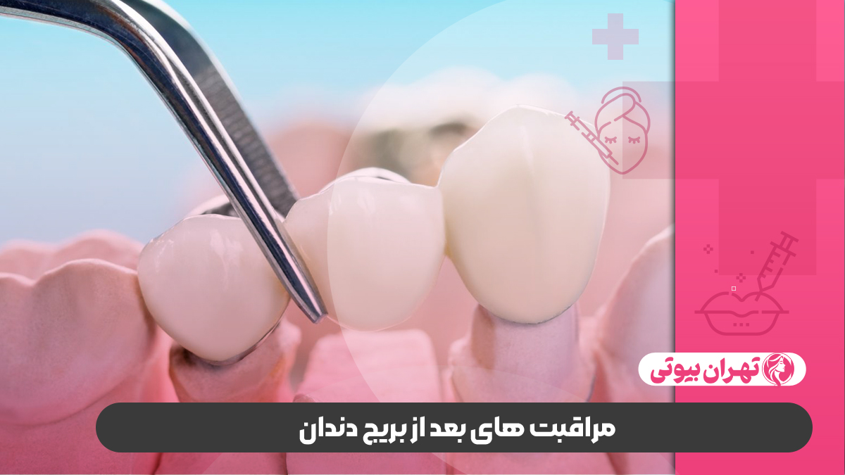 10 بهترین دکتر بریج دندان در کرج