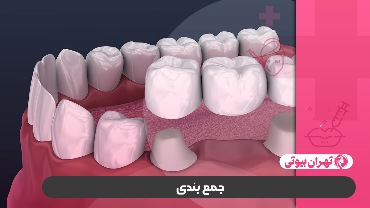 10 بهترین دکتر بریج دندان در کرج