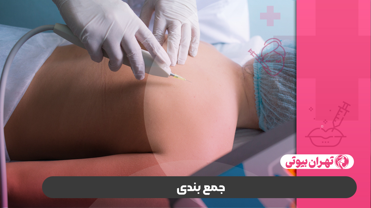 10 بهترین مرکز کربوکسی تراپی در کرج