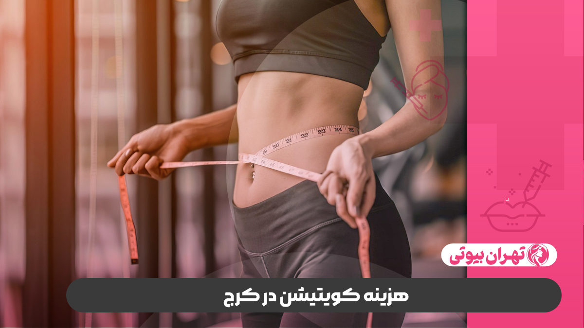 10 بهترین مرکز کویتیشن در کرج