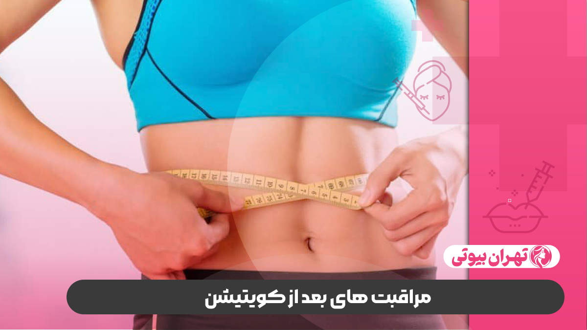 10 بهترین مرکز کویتیشن در کرج