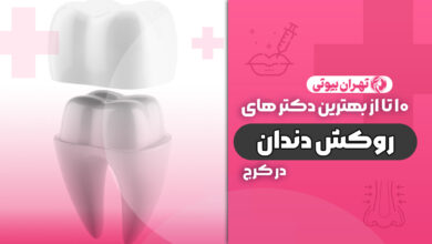10 بهترین دکتر روکش دندان در کرج