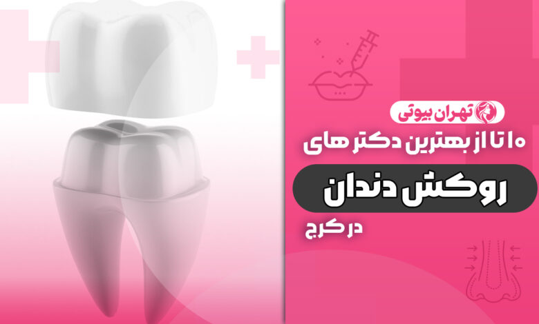 10 بهترین دکتر روکش دندان در کرج