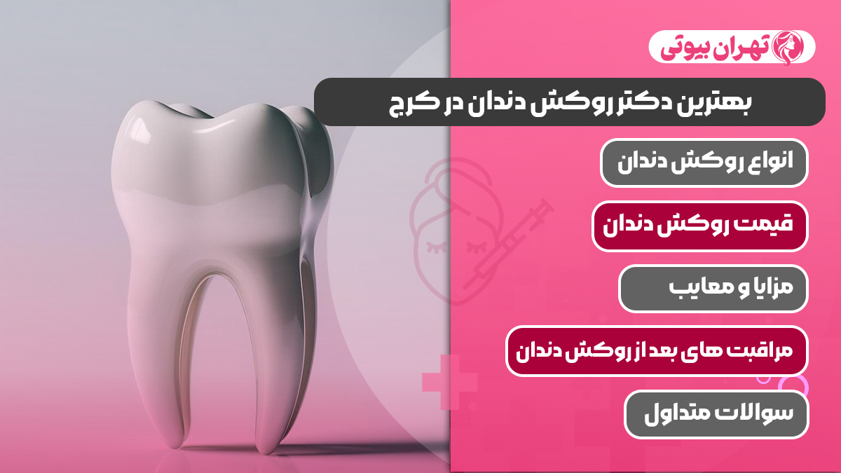 10 بهترین دکتر روکش دندان در کرج