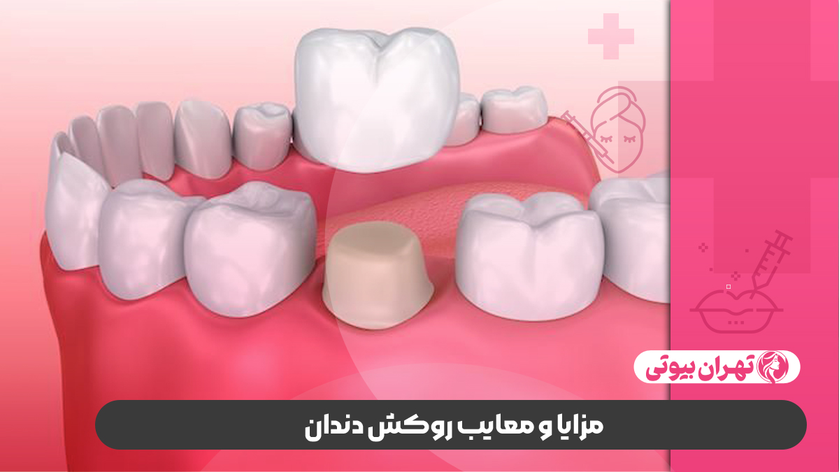 10 بهترین دکتر روکش دندان در کرج