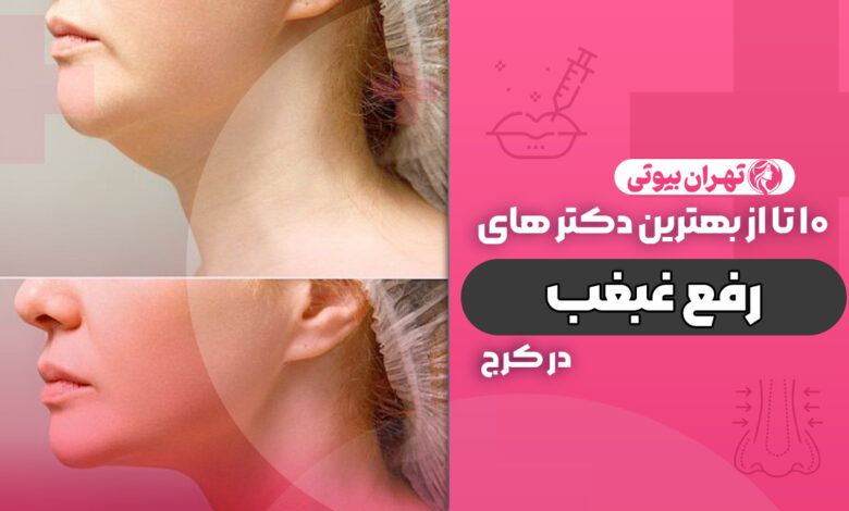 10 بهترین دکتر رفع غبغب در کرج