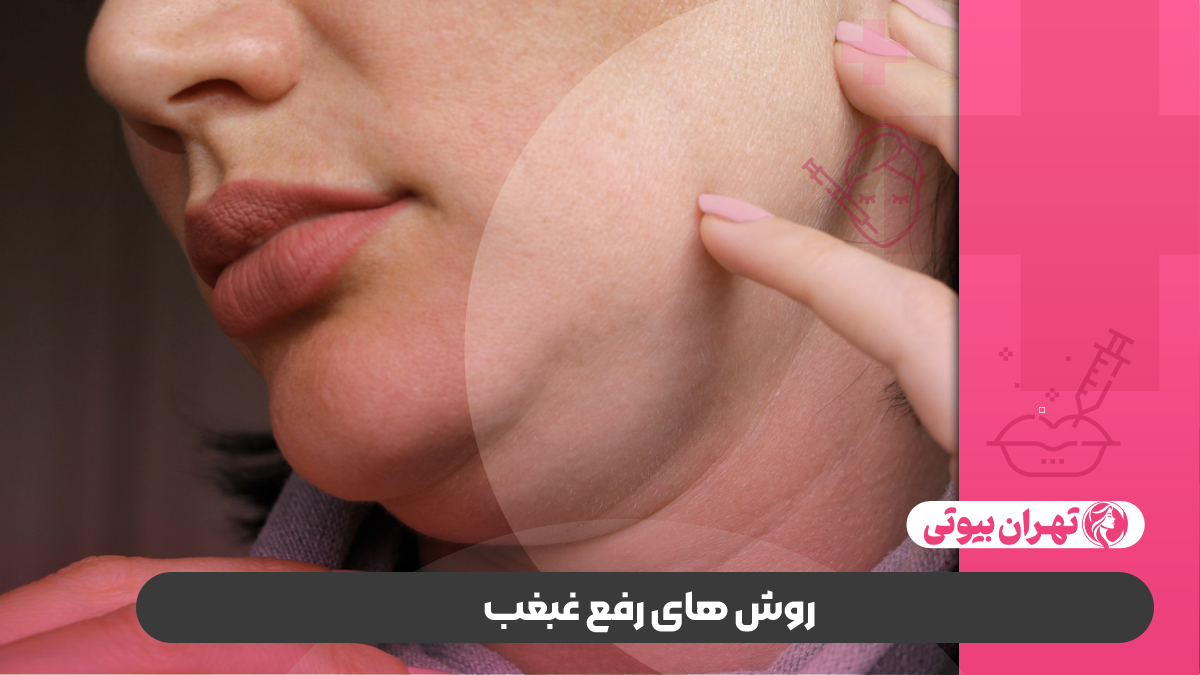 10 بهترین دکتر رفع غبغب در کرج